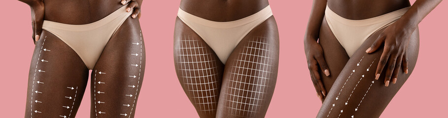 Young black women in beige lingerie with lines for body shaping or drainage massage isolated on pink background
