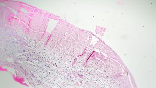 Teased human tendon in cross section filmed under microscope 40x on bright field. Educating piece of people ligament with professional biological device in laboratory. Structure of connective fibers