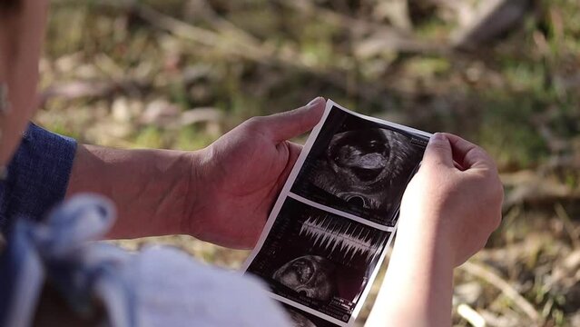 Close-up of a couple's hands looking at an ultrasound of their baby. Concept of people and lifestyles.