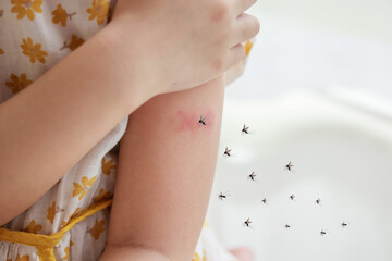 Little girl has skin rash allergy and itchy on her arm from mosquito bite