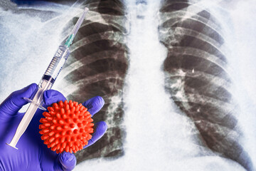 a hand in a blue medical glove holds a syringe with medicine and a coronavirus molecule against the background of an X-ray of the lungs