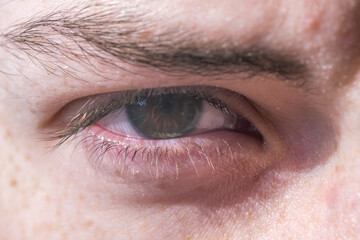  close up right eye of a teenager with freckles