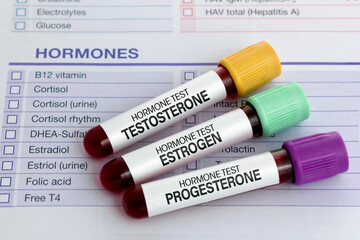 samples of Blood for sexual hormones Analysis Testosterone, Estrogen and Progesterone in men and women. Blood test tubes for Testosterone, Estrogen and Progesterone analysis hormonal  - obrazy, fototapety, plakaty