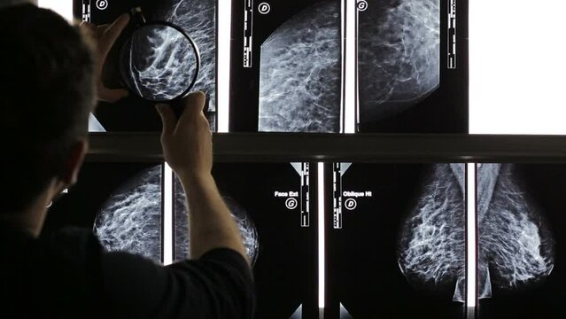 Doctor with magnifying glass checking mammogram x-ray. Mammography diagnostic to prevent breast cancer.