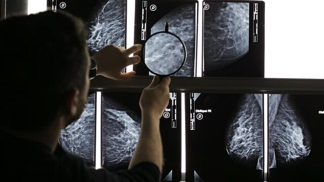 Doctor with magnifying glass checking mammogram x-ray. Mammography diagnostic to prevent breast cancer.