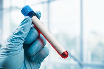 Scientist hand with blood sample tube