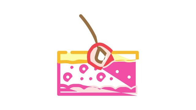 folliculitis skin disease problem color icon animation