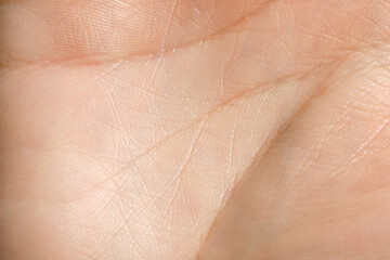 Fototapeta premium Closeup view of human hand with dry skin