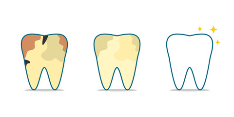 Set before after different tooth decay stains to white shiny clean tooth dental cartoon character on white background icon flat vector design.