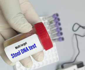 Fecal sample for MT-sDNA (Multi-Target Stool DNA) Test, to diagnosis colorectal cancer, colorectal...