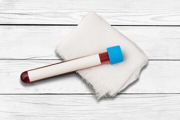 Blood test tube sample on the desk