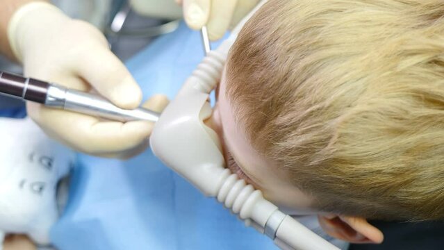 Dentist using nitrous oxide in dental clinic while treating young patients with milk teeth. Relaxation of patient before surgical or dental procedures. Child lying in dental chair with inhalation