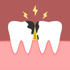 Tooth decay stains food particles on gum in mouth with toothache yellow spark bolt dental cartoon character icon flat vector design.