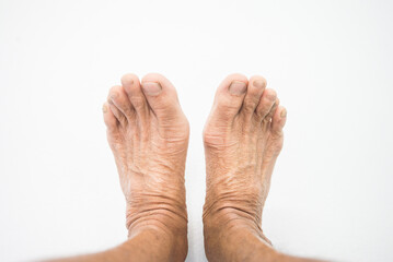 feet on a white background