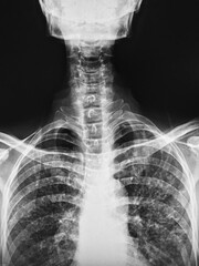x ray image of a skull