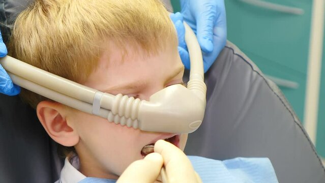 Dentist using nitrous oxide in dental clinic while treating young patients with milk teeth. Relaxation of patient before surgical or dental procedures. Child lying in dental chair with inhalation