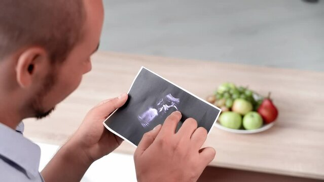 pregnancy, young man is preparing to become father and is examining a photo of an ultrasound while sitting at home