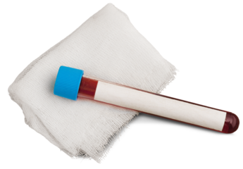 Covid-19 vaccine cost concept. Tube vaccine