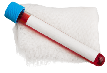 Covid-19 vaccine cost concept. Tube vaccine