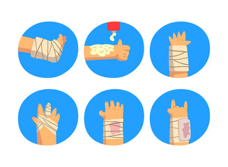First Aid for Wounded Arm and Leg in Blue Circle Vector Set