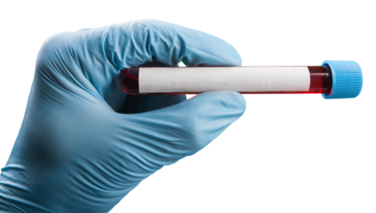 Doctor hand holds a Coronavirus vaccine jointly developed, immunization and treatment of Coronavirus