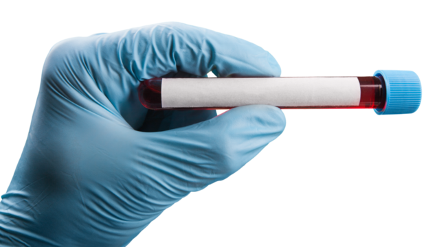 Doctor hand holds a Coronavirus vaccine jointly developed, immunization and treatment of Coronavirus