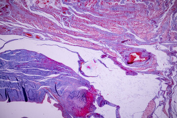 Developing of nail, human embryo under the microscope in Lab.