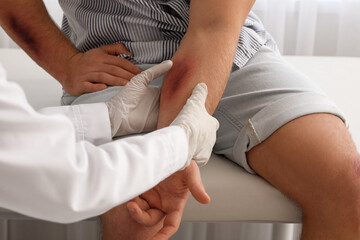 Obraz premium Doctor examining man with bruises in clinic, closeup