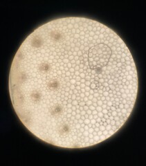 The picture of monocot stem under microscope