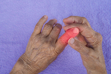 hands of old lady with osteoporosis pain and wrinkles. arthritis disease