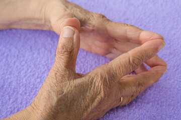 hands of old woman with bone pain and wrinkles. arthritis disease symptom in old age