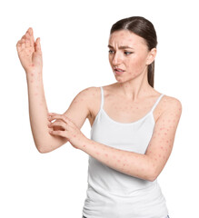 Fototapeta na wymiar Woman with rash suffering from monkeypox virus on white background