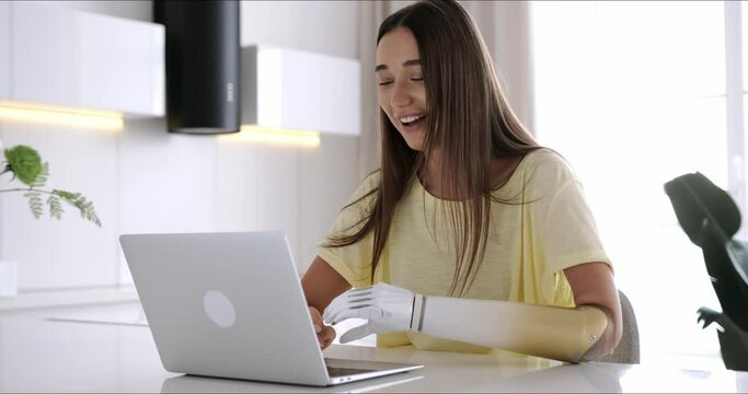 Motivated woman talking with friends, making video call, using prosthetic arm to working or learning notebook computer, girl with disability typing text artificial prosthetic limb