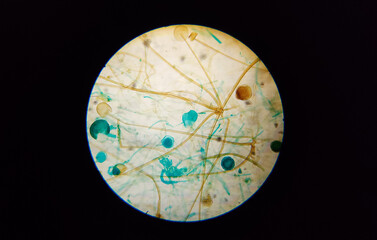 Microscopic view of Rhizopus fungus. 