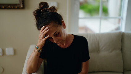 Middle age hispanic woman suffering for domestic violence with bruise on eyes at home