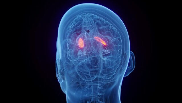 3D medical animation of a man's lateral globus pallidus