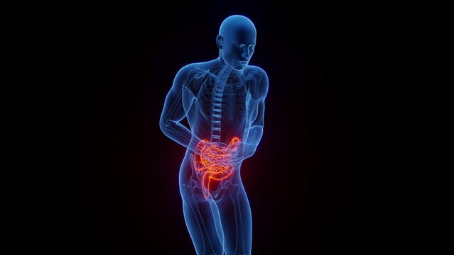 3D medical animation of a man experiencing abdominal pain