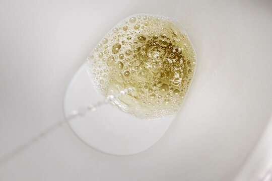 The lavatory in the toilet and the stream of urine during urination