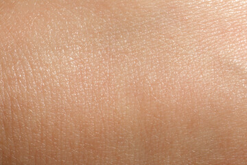 Closeup view of dry human skin as background