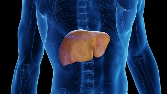 3D medical animation of a man's healthy liver turning into a fatty liver
