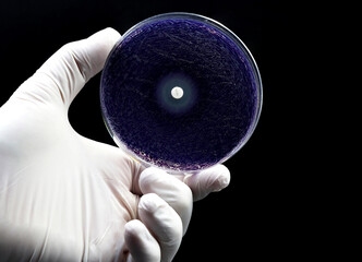 A doctor's or researcher's hand holding a Petri dish with a culture of bacteria on which an...