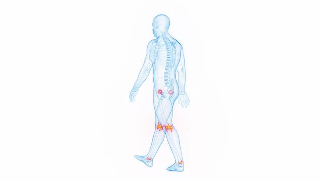 3D medical animation of a man having joint pain while walking