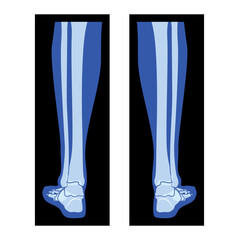 X-Ray Foot Legs Skeleton, Fibula, Tibia - Phalanges Human body, Bones adult people roentgen back view. 3D flat blue color concept Vector illustration of medical anatomy isolated on black background