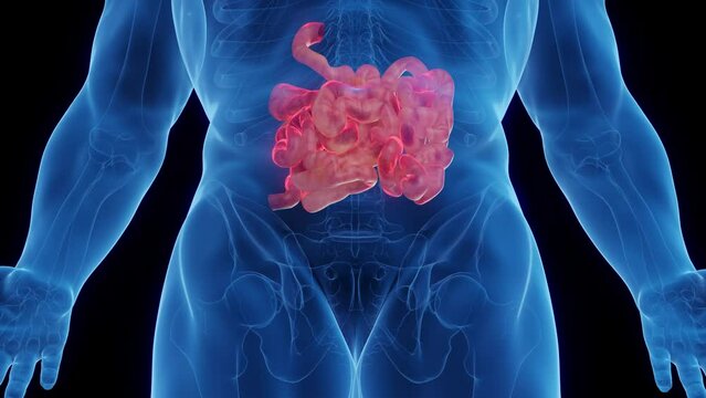3D medical animation of a man's inflamed small intestine