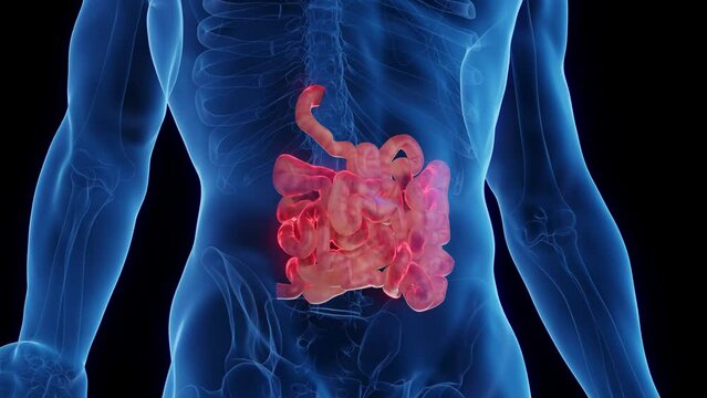 3D medical animation of a man's inflamed small intestine