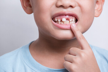 boy face looking at tooth and showing teeth behind on white background. First teeth changing.
