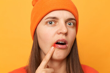 Portrait of sick shocked woman wearing orange jumper and beanie hat standing isolated over yellow background, has oral herpes, indicates at wound near lips, looking at camera, health problems.
