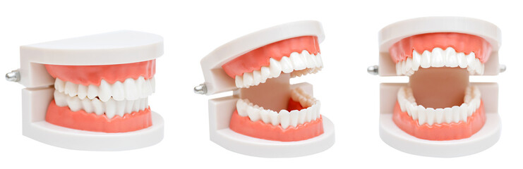 Dental model of the jaw in different positions on a white background. Oral hygiene
