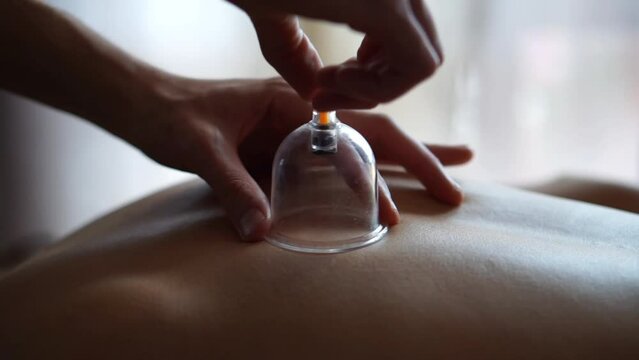 Horizontal close-up video of a person placing suction cups on the back, unrecognizable people.