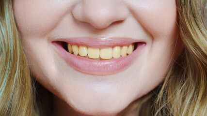 close-up. a woman's smile with yellow teeth.